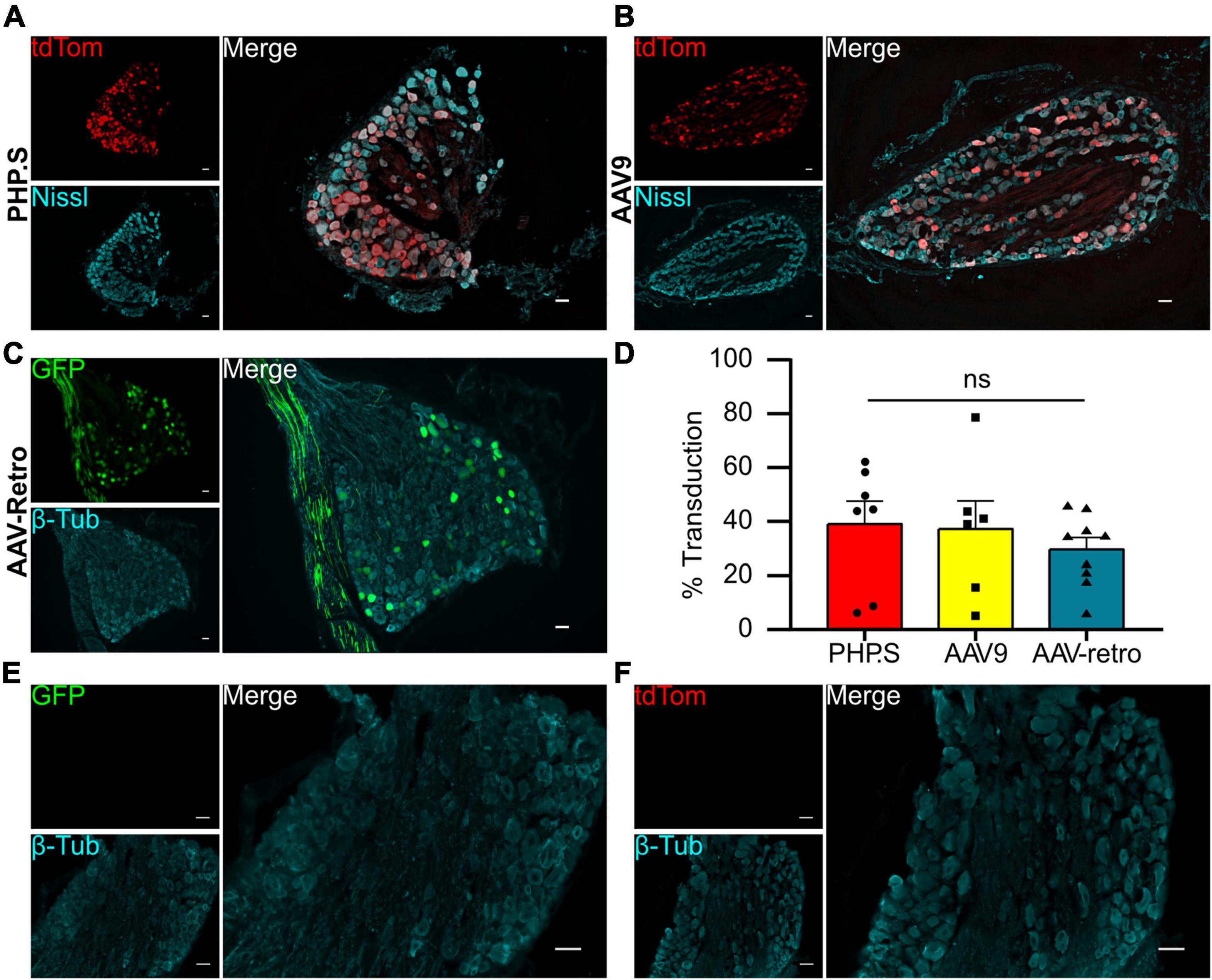 Evaluating the transduction efficiency of systemically delivered AAV vectors in the rat nervous system